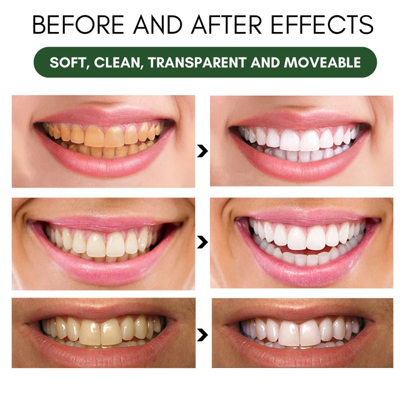 EELHOE™ | NATURAL WHITENING TOOTHPASTE