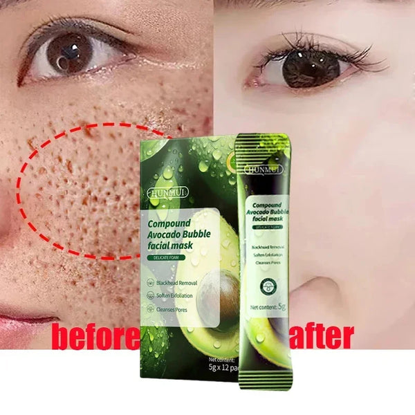 Salicylic Acid Pore Shrinking Mask Quick Elimination Large Pores Remove Blackehead Tighten Face Smooth Skin