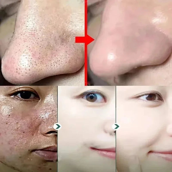 Salicylic Acid Pore Shrinking Mask Quick Elimination Large Pores Remove Blackehead Tighten Face Smooth Skin